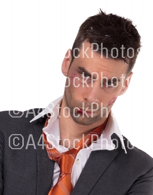 Close up of a businessman with bloody lip, beaten and bruised