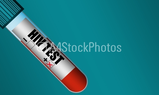 Test tube with sample blood positive HIV virus